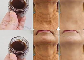 Magisches Anti-Aging-Öl: Kaffeeöl, das Falten glättet und stärker ist als Botox!