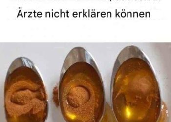 Zimt und Honig: Das stärkste Heilmittel, das selbst Ärzte nicht erklären können