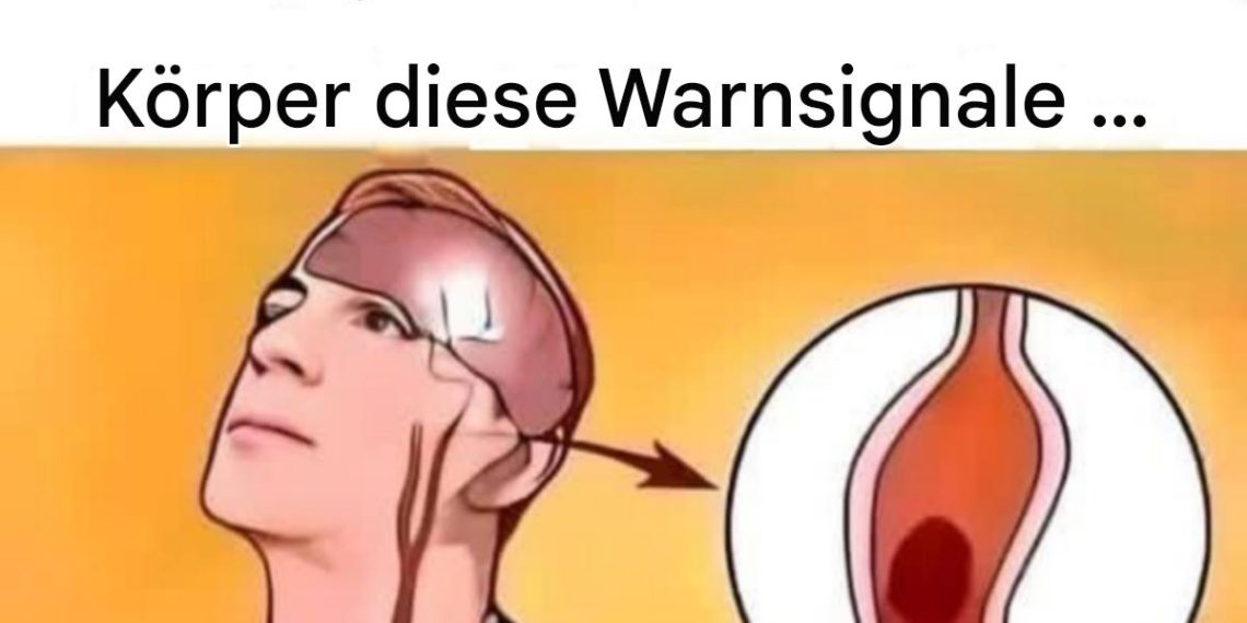 Schlaganfall symptome: Was sind die Warnsignale?