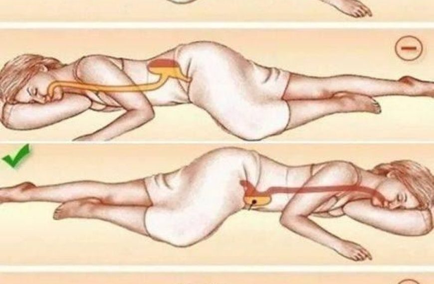 Das Schlafen auf der linken Seite beeinträchtigt Ihre Gesundheit auf eine Art und Weise, die Sie nie für möglich gehalten hätten