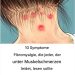 10 Symptome von Fibromyalgie, die jeder mit Muskelschmerzen lesen sollte