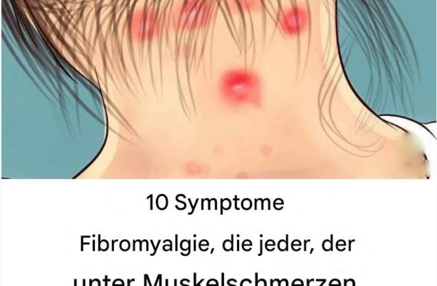 10 Symptome von Fibromyalgie, die jeder mit Muskelschmerzen lesen sollte