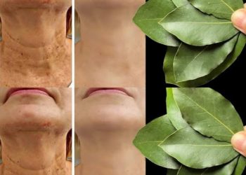 Ist Lorbeerblatt 100.000 Mal wirksamer als Botox? | Natürlicher Faltenentferner, auch mit 70