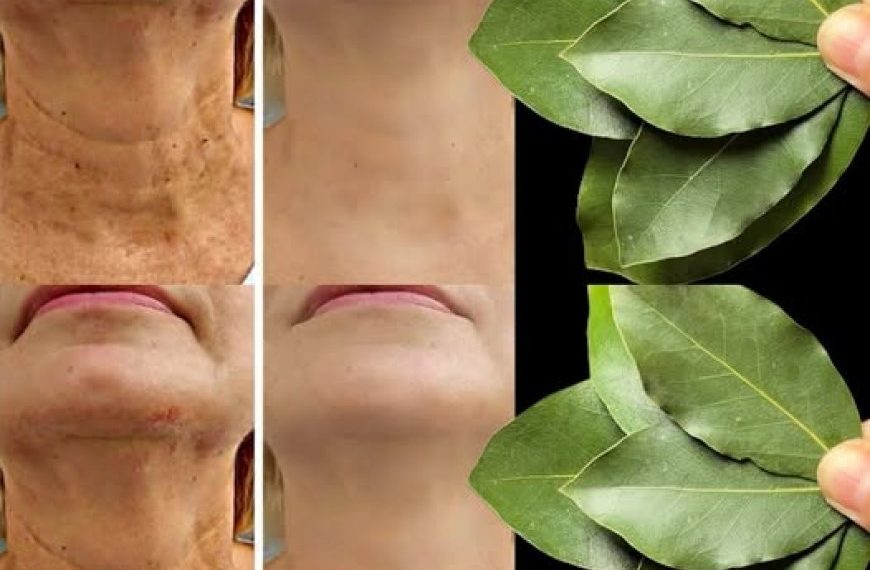 Ist Lorbeerblatt 100.000 Mal wirksamer als Botox? | Natürlicher Faltenentferner, auch mit 70