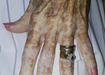 Eine Krankenschwester machte ein Foto von einer älteren Frau, das schnell viral ging. Die Geschichte berührte viele Menschen und verbreitete eine starke Botschaft über Lebenserfahrung und Selbstakzeptanz.