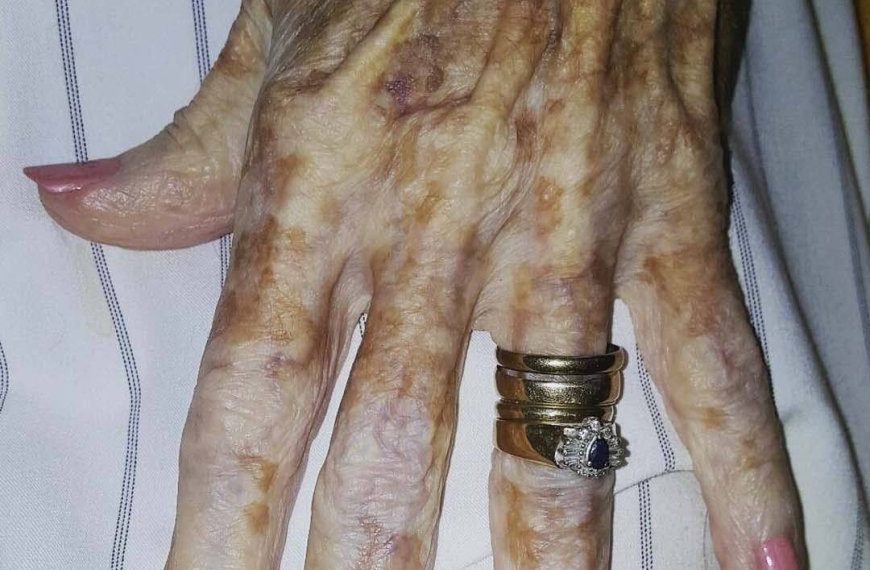 Eine Krankenschwester machte ein Foto von einer älteren Frau, das schnell viral ging. Die Geschichte berührte viele Menschen und verbreitete eine starke Botschaft über Lebenserfahrung und Selbstakzeptanz.