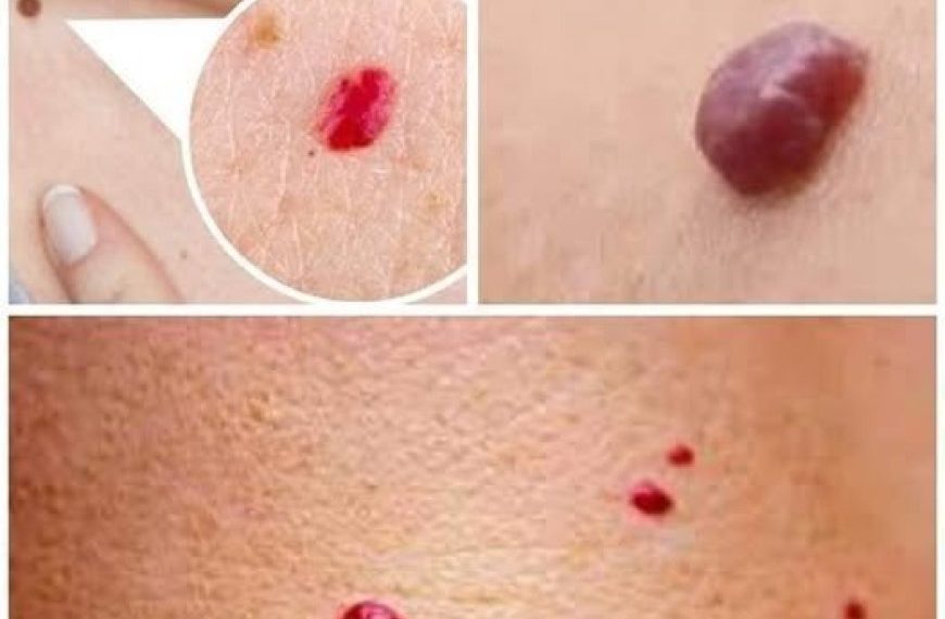 Wenn Sie rote Punkte auf Ihrer Haut entdecken, bedeuten sie Folgendes