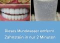 So bekommen Sie weiße Zähne: 15 Tipps für ein schönes Lächeln