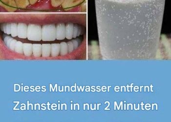 So bekommen Sie weiße Zähne: 15 Tipps für ein schönes Lächeln