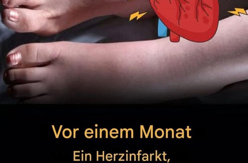 Einen Monat vor einem Herzinfarkt warnen Sie Ihre Füße vor diesen 6 Anzeichen