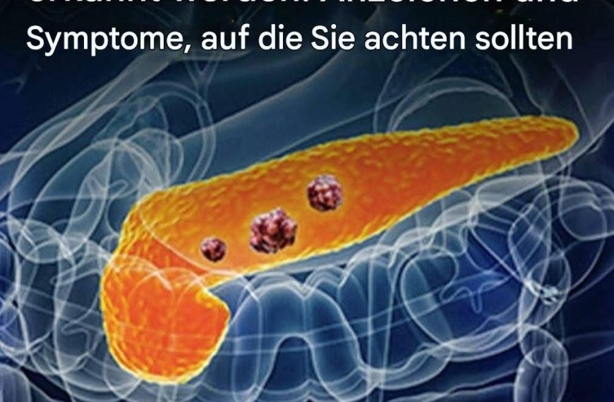 10 Anzeichen von Bauchspeicheldrüsenkrebs, die Sie nicht ignorieren sollten
