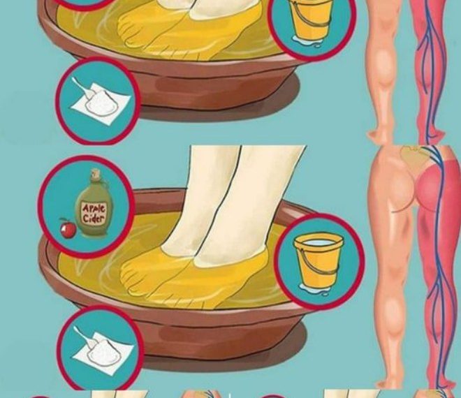 Eine einfache 10-Minuten-Methode zur erfolgreichen Linderung von Schmerzen des Ischiasnervs