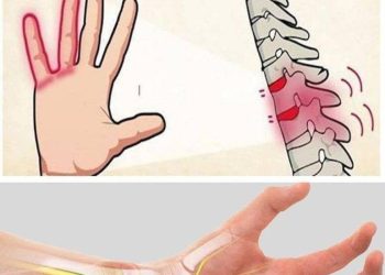 Taube Hände: Ist das normal oder ein Anzeichen für ein Problem?