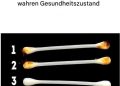 Unsere Ohren verraten den wahren Zustand unserer Gesundheit