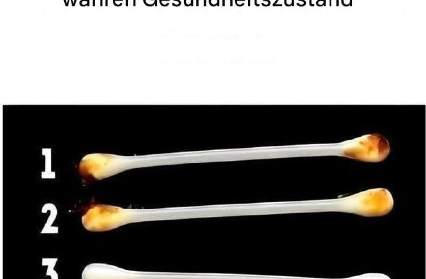 Unsere Ohren verraten den wahren Zustand unserer Gesundheit