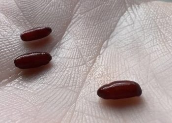 Ich habe gerade dieses Zeug auf meinem Bett gefunden, es macht mir ein bisschen Angst, was ist das?